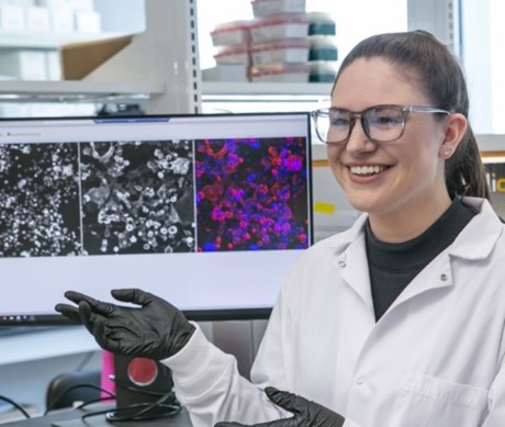 An CSB scientist showing immunofluorescence data.